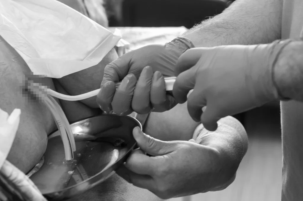 feche-mao-medico-enquanto-cirurgiao-e-assistente-realizando-cirurgia-na-equipe-medica-usando-varios-instrumentos-cirurgicos-na-sala-de-cirurgia